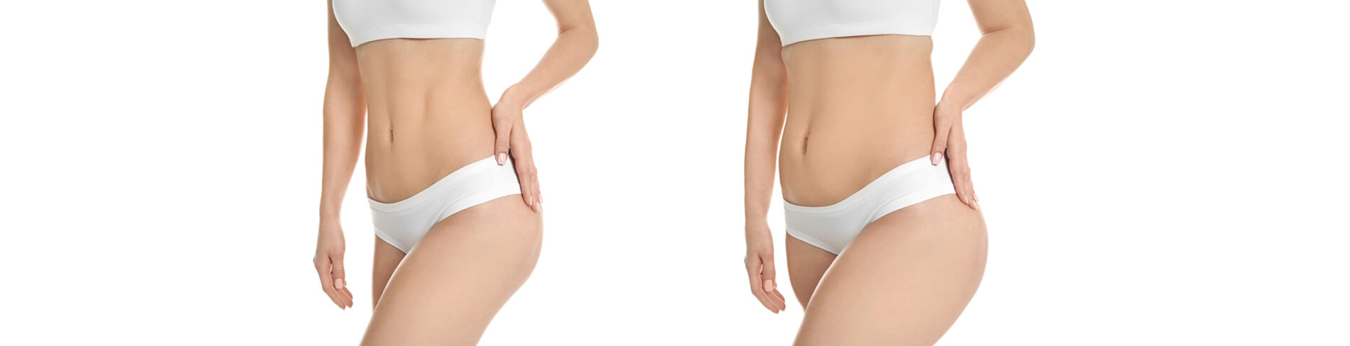 Liposuction Turkey Istanbul Antalya Izmir Bodrum